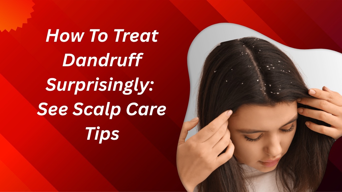 Treat Dandruff Fast